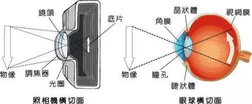 白内障如何选择适合自己的晶体