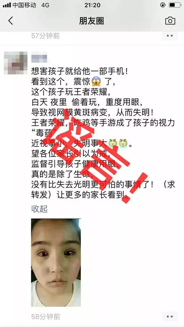 玩手机导致眼部黄斑病变？