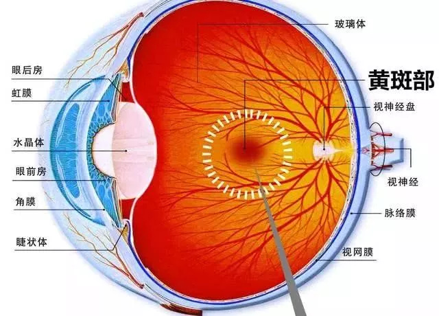 玩手机导致眼部黄斑病变？