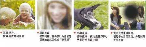 玩手机导致眼部黄斑病变？
