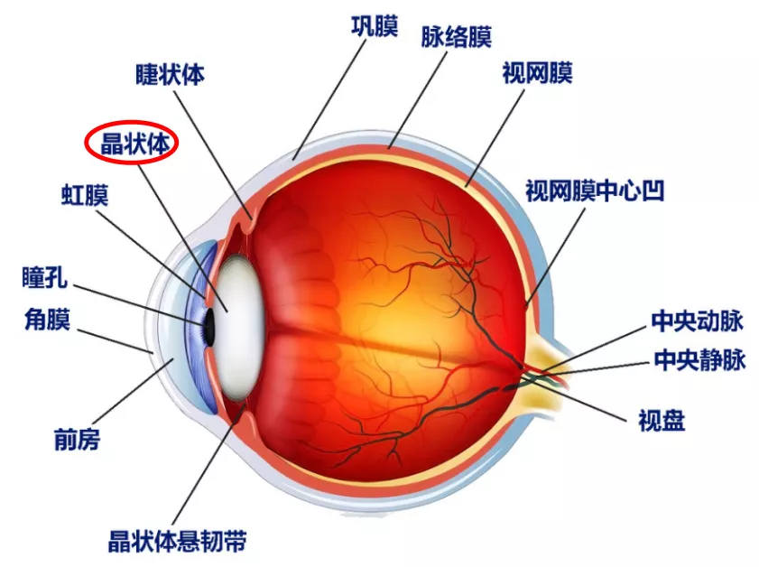 为什么白内障手术都做了，还要长白内障？！