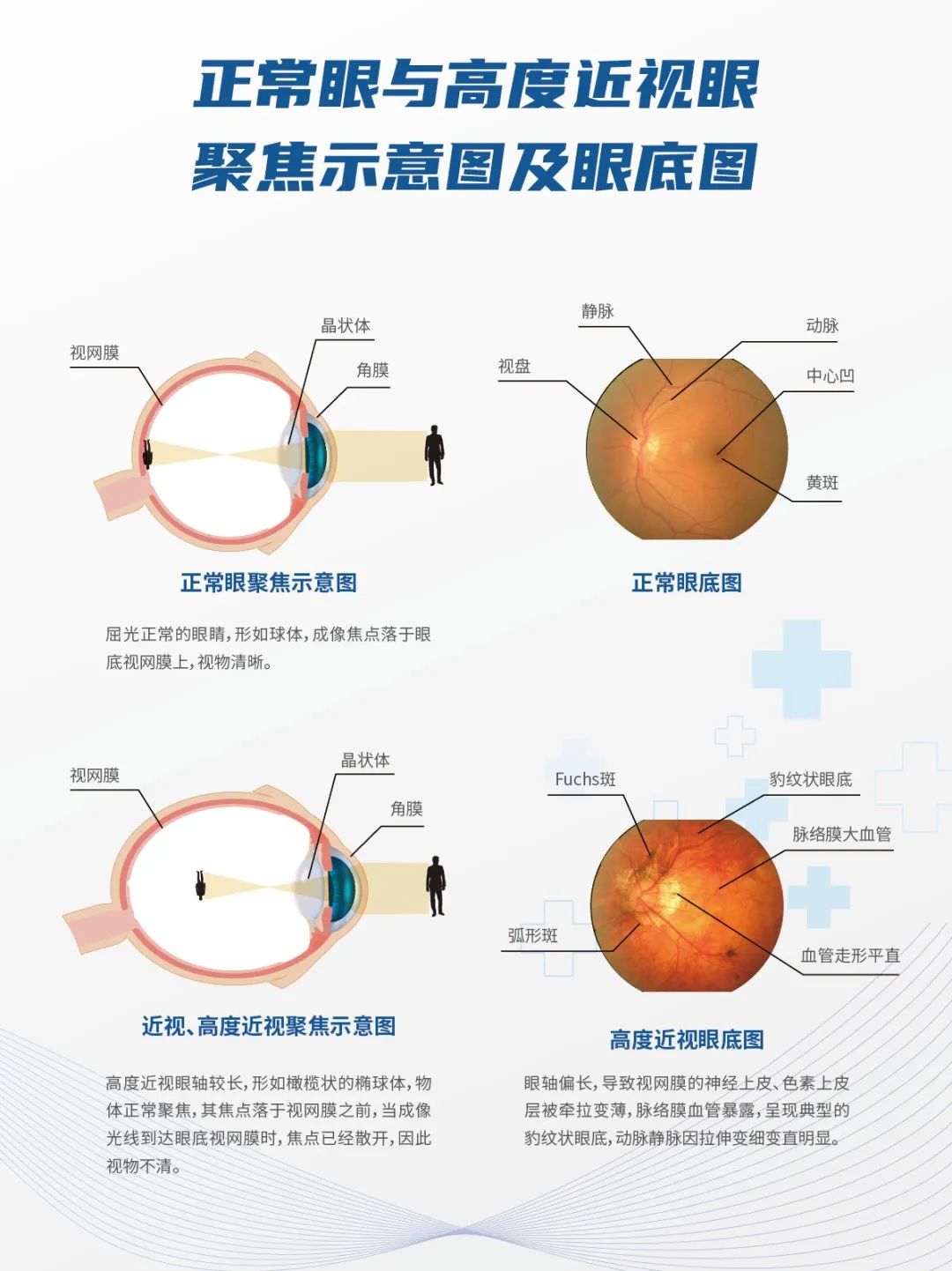 开学第一课丨眼健康检查