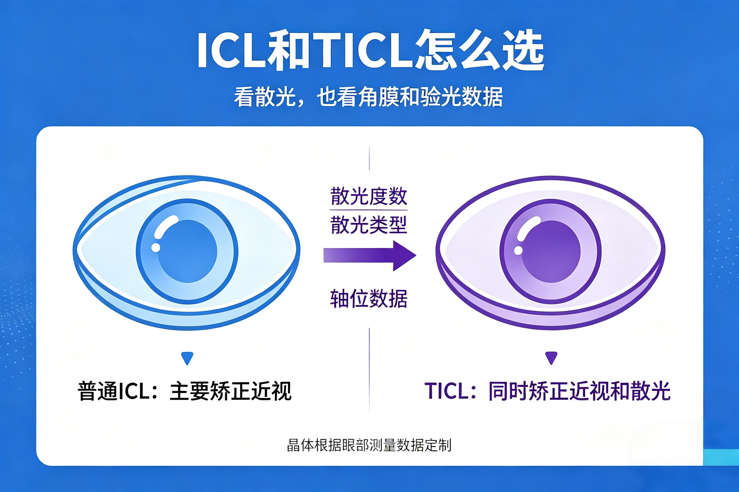 ICL 晶体旋转是什么情况，TICL 散光晶体旋转的原因与处理