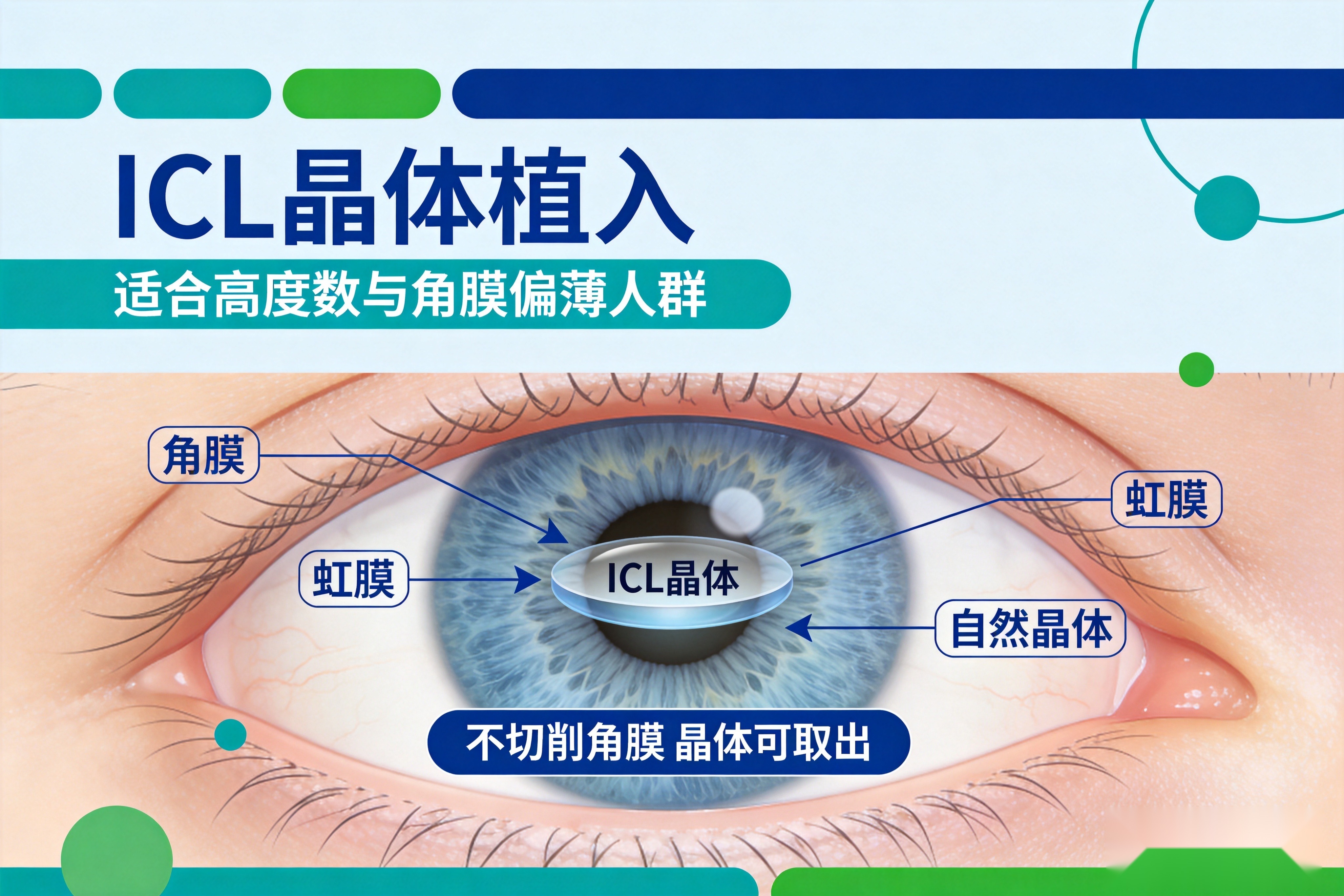 昆明全飞秒和ICL晶体植入怎么选?理清这三个问题就有答案